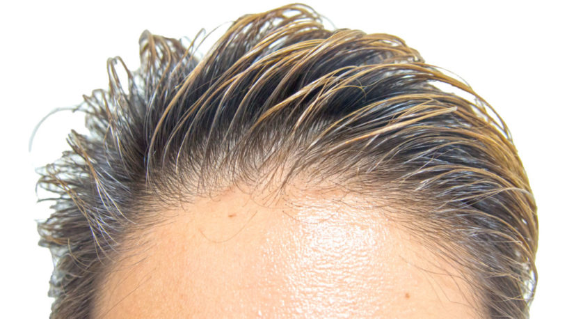 筋トレしたらハゲますか？